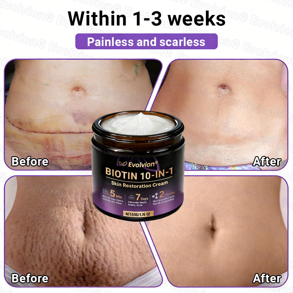 Made and Shipped from Australia ✨ Evolvion® Biotin 10-in-1 Skin Restoration Cream 🌈🌈