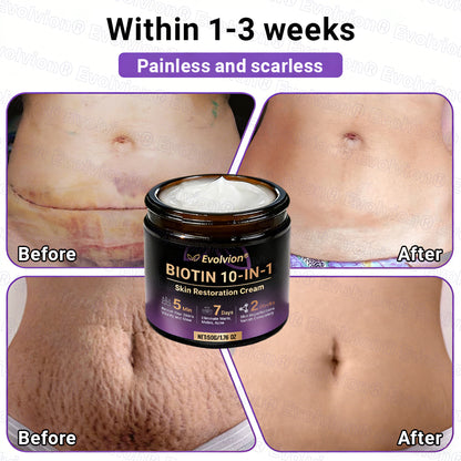 Made and Shipped from Australia ✨ Evolvion® Biotin 10-in-1 Skin Restoration Cream 🌈🌈