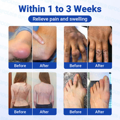 𝐎𝐟𝐟𝐢𝐜𝐢𝐚𝐥 𝐒𝐭𝐨𝐫𝐞 🇦🇺 | GFOUK® BPC-157 × NSAID 10-in-1 Penetrating Greaseless Arthritis Gel -up