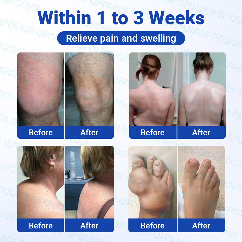 𝐎𝐟𝐟𝐢𝐜𝐢𝐚𝐥 𝐒𝐭𝐨𝐫𝐞 🇦🇺 | GFOUK® BPC-157 × NSAID 10-in-1 Penetrating Greaseless Arthritis Gel -up