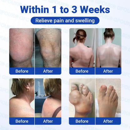 𝐎𝐟𝐟𝐢𝐜𝐢𝐚𝐥 𝐒𝐭𝐨𝐫𝐞 🇦🇺 | GFOUK® BPC-157 × NSAID 10-in-1 Penetrating Greaseless Arthritis Gel -up