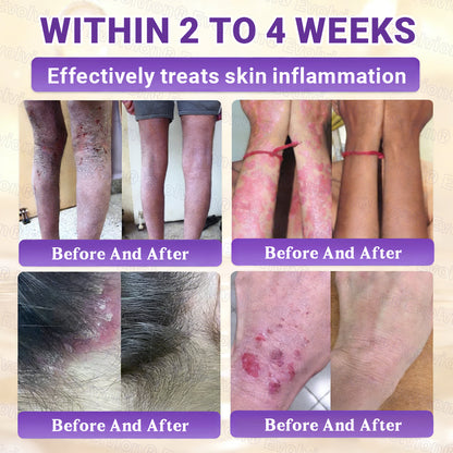 Made and Shipped from Australia ✨ Evolvion® Biotin 10-in-1 Skin Restoration Cream 🌈🌈