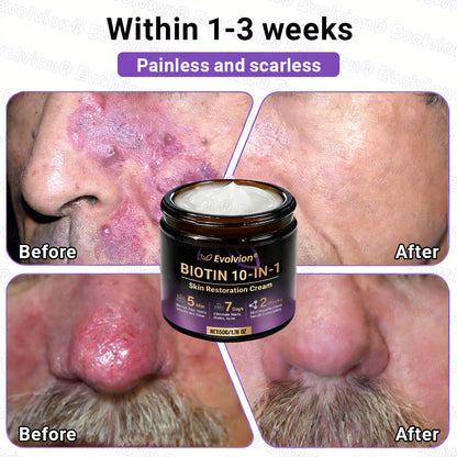 Made and Shipped from Australia ✨ Evolvion® Biotin 10-in-1 Skin Restoration Cream 🌈🌈