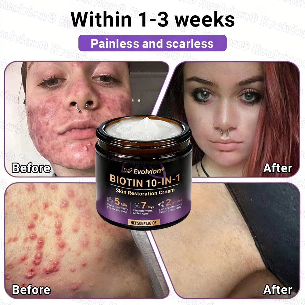 Made and Shipped from Australia ✨ Evolvion® Biotin 10-in-1 Skin Restoration Cream 🌈🌈